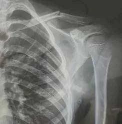 赤峰市教育局介入<strong></p>
<p>三角货币对冲指标</strong>,家长称:孩子拨弄开关被另一班班主任打伤