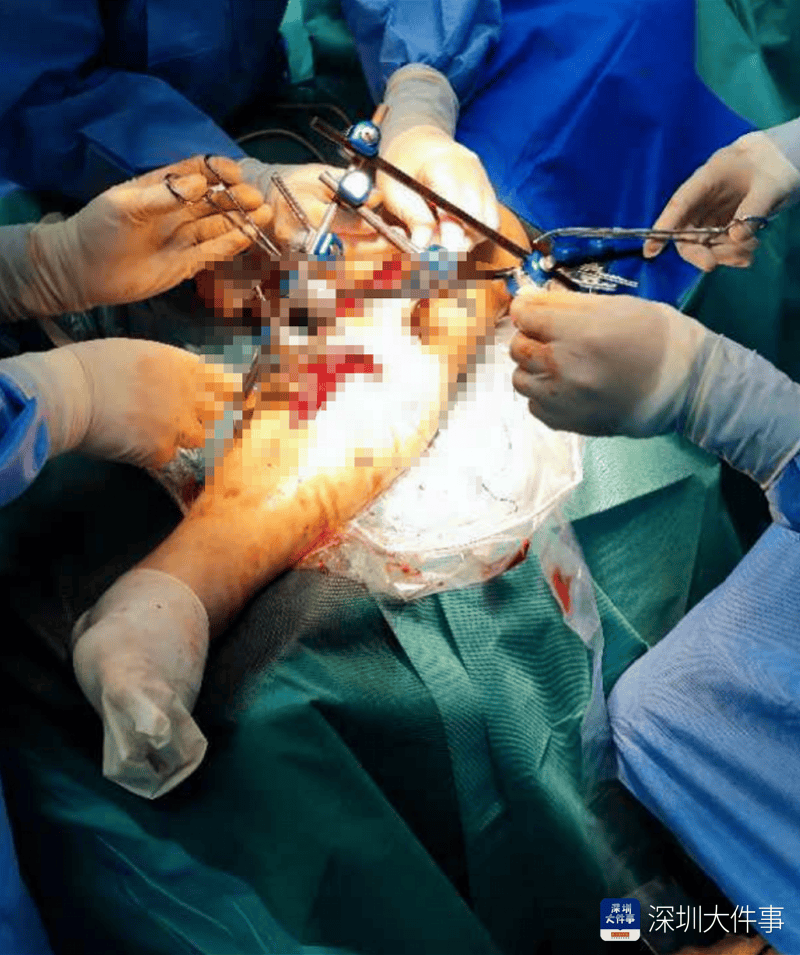 失血过半！深圳男子被三四百斤模具砸到<strong></p>
<p>其他货币资金保证金</strong>，医生全力抢救
