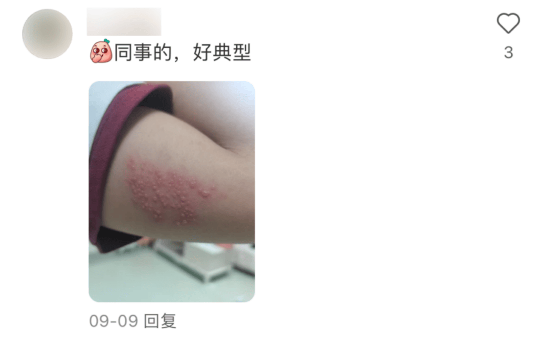 一旦感染终身携带<strong></p>
<p>非货币交易账务处理</strong>！深圳疾控提醒：这4类人要注意