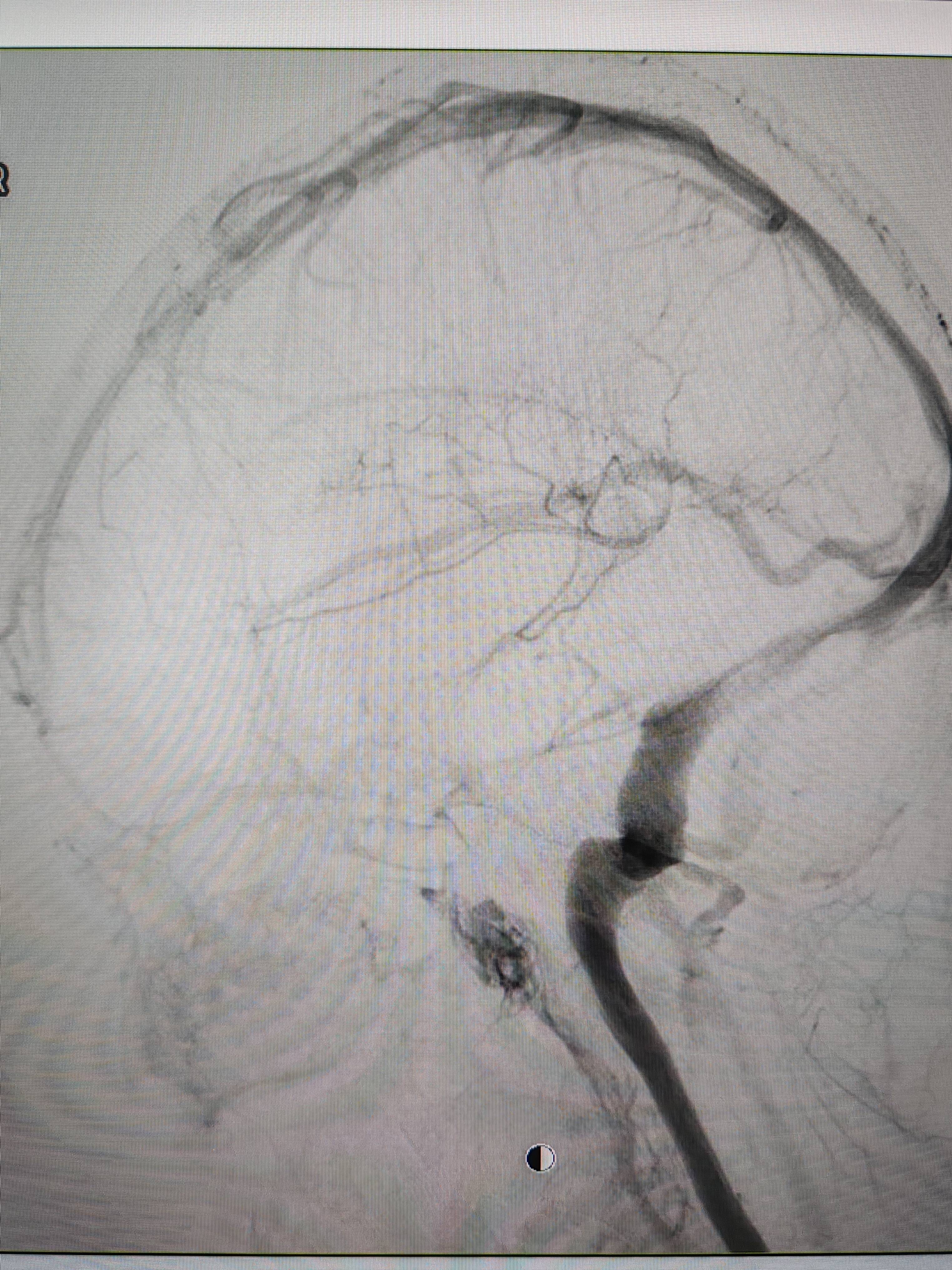 吉林女子患罕见耳鸣7年<strong></p>
<p>truechain币行情</strong>，慕名千里来顺德寻医终获新生