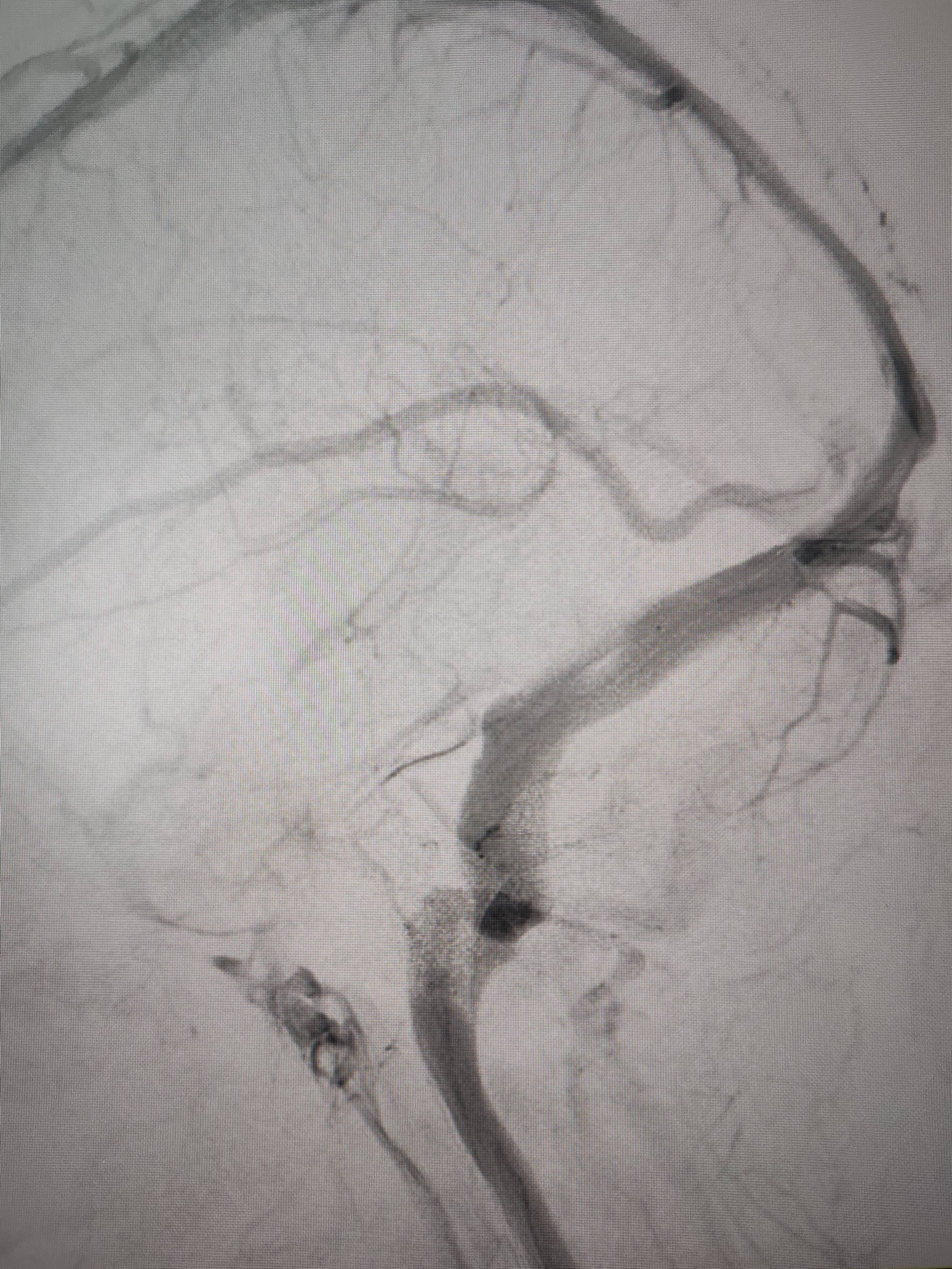 吉林女子患罕见耳鸣7年<strong></p>
<p>truechain币行情</strong>，慕名千里来顺德寻医终获新生