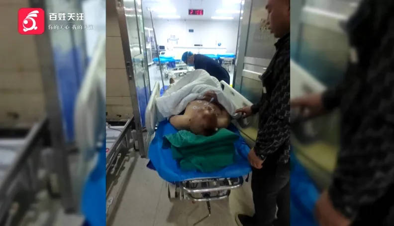 男子聚会上因不喝酒被朋友揍进ICU<strong></p>
<p>母币比普通币贵多少</strong>，头盖骨取出来10多块，打人者哥哥竟说...