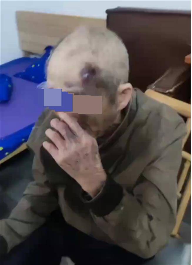 广东阳江一养老院护工长期虐待九旬老人?民政局已介入<strong></p>
<p>货币对冲套利原理</strong>,警方:正了解情况