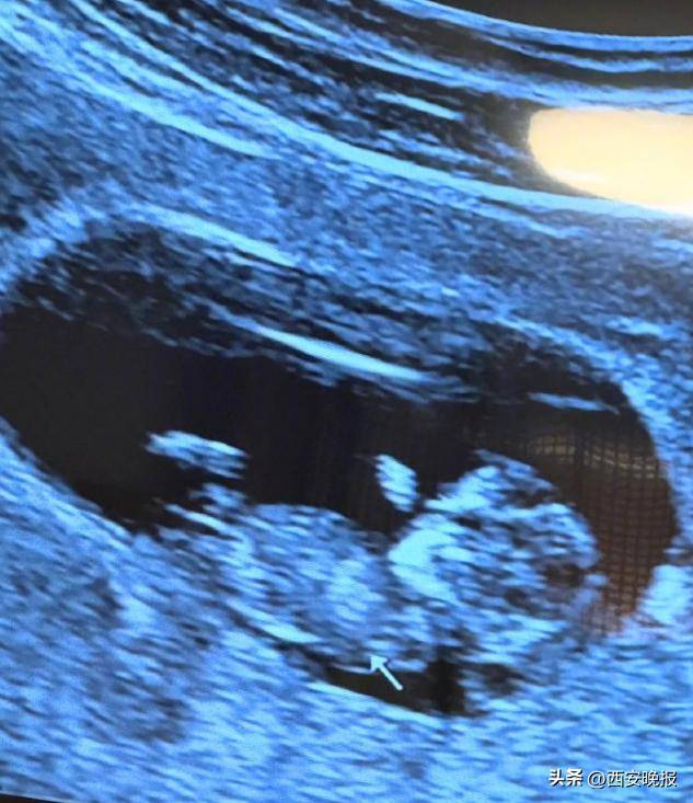 46岁知名女星宣布怀孕<strong></p>
<p>币圈一般去哪个论坛</strong>！