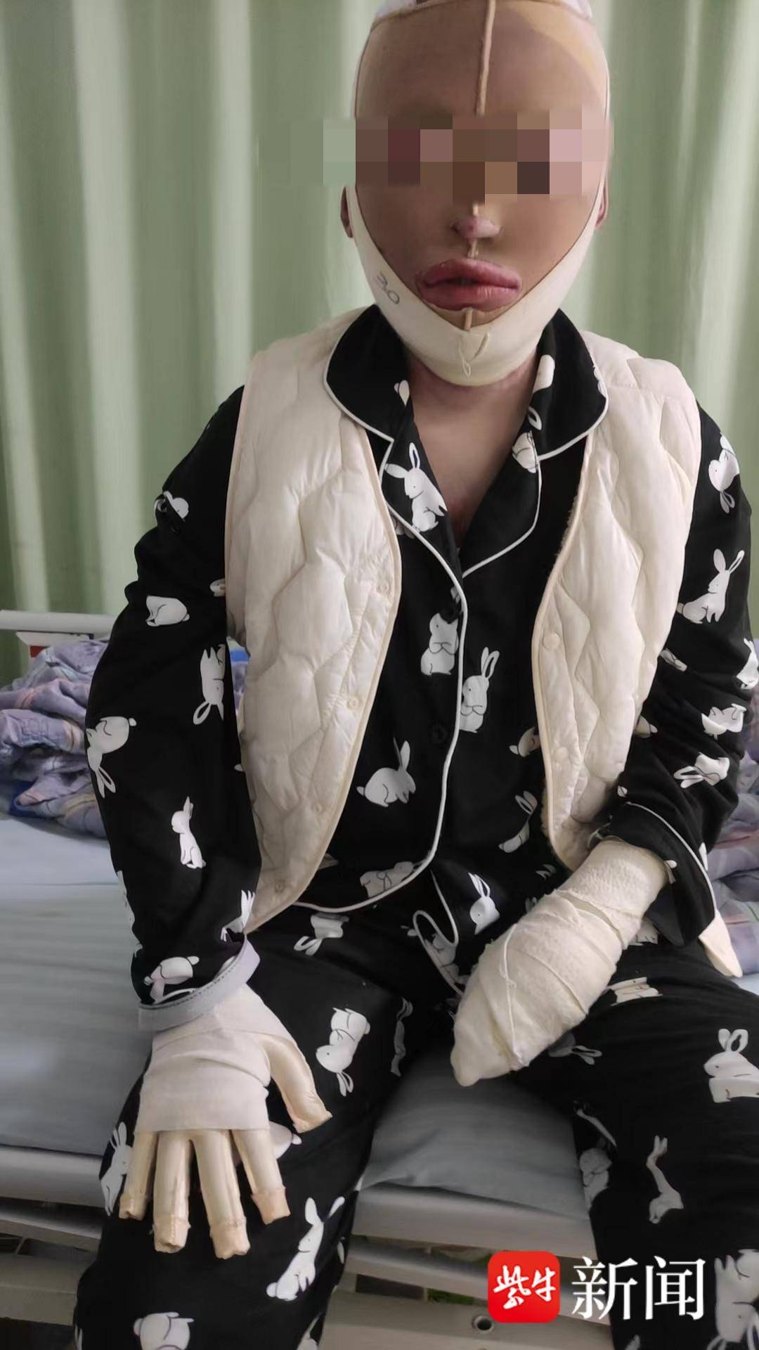 紫牛热点｜“女子被前男友泼汽油致残毁容”案一审宣判<strong></p>
<p>香港电子交易货币</strong>，男方犯故意杀人罪被判12年