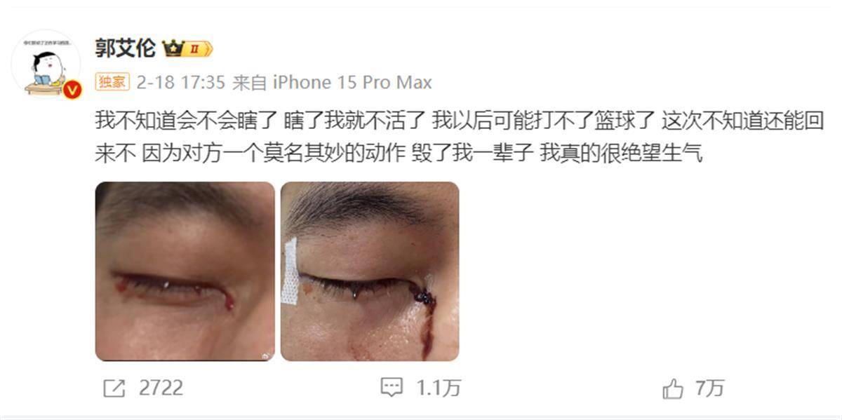 郭艾伦发文报平安：已顺利拆线<strong></p>
<p>交易指数如何计算</strong>，相信一定会重回球场