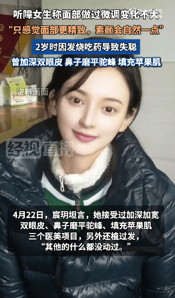 “美院聋哑女生因长相太完美”登热搜第一<strong></p>
<p>如何成为炒币高手</strong>，本人承认微调：不太上镜，比照片视频好看