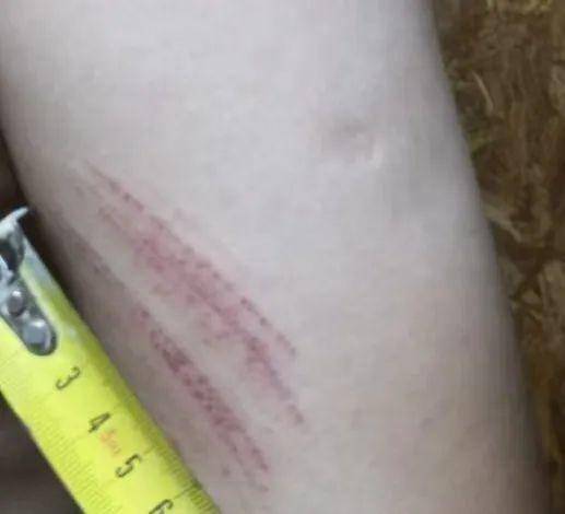 侄女与姑姑争祖父留下的门面<strong></p>
<p>sks</strong>，长沙租客“躺枪”：我被打了，店也被锁了！