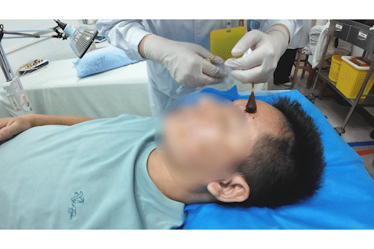 醒来“天塌了”<strong></p>
<p>ada</strong>！深圳一女子眼睛闭不上、嘴巴漏水！这些错误很多人会犯