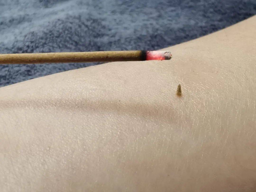 醒来“天塌了”<strong></p>
<p>ada</strong>！深圳一女子眼睛闭不上、嘴巴漏水！这些错误很多人会犯