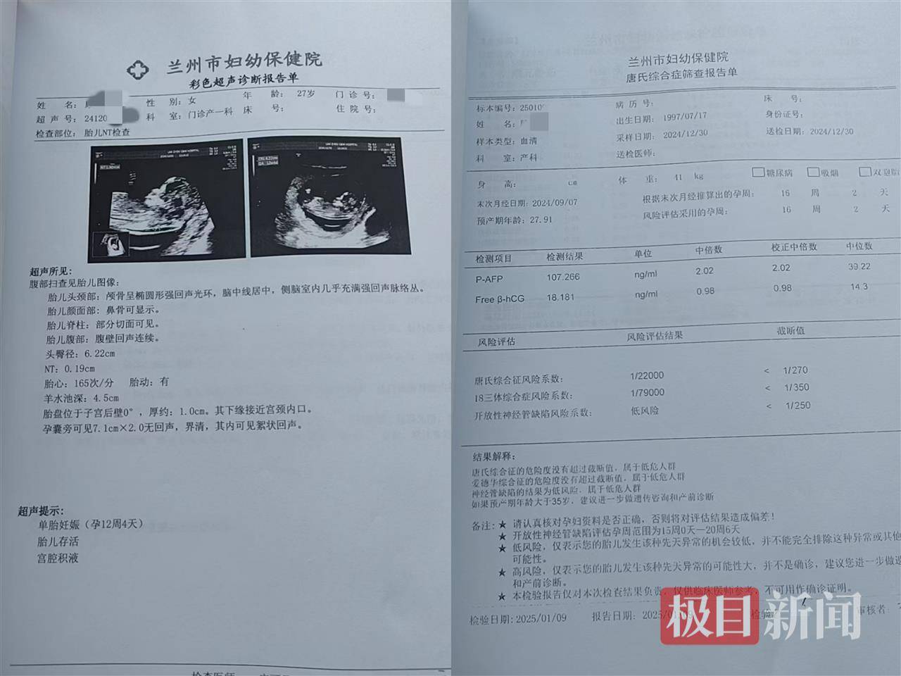 二胎出生查出先天性病症或落下残疾<strong></p>
<p>大饼</strong>，残疾父母称医院产检漏检、未尽告知义务，医院及医调委回应