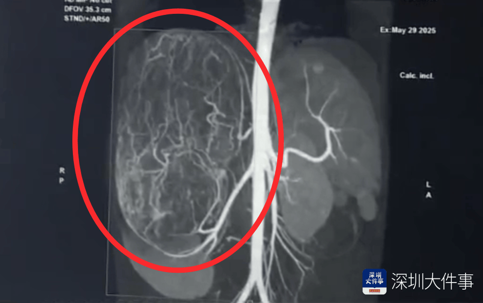 店员试衣间里一句警告，竟救了17岁少女！一家人火速赶到深圳