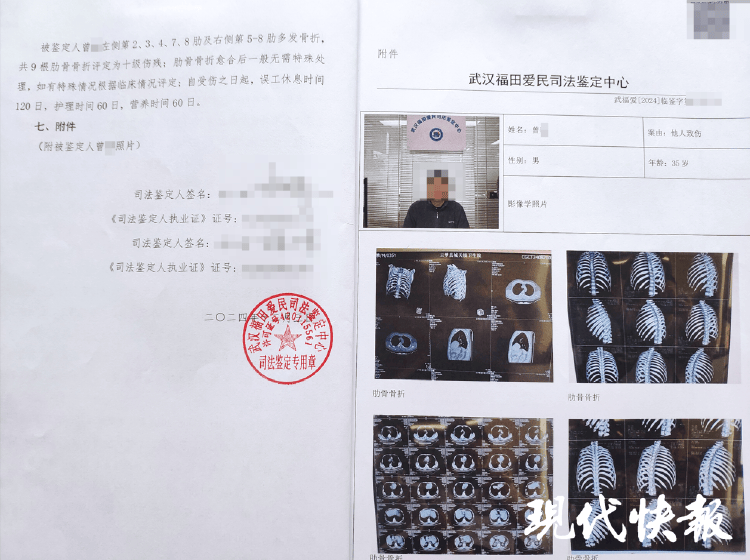 湖北一男子称被交警打断9根肋骨未立案<strong></p>
<p>王宝强</strong>，警方回应