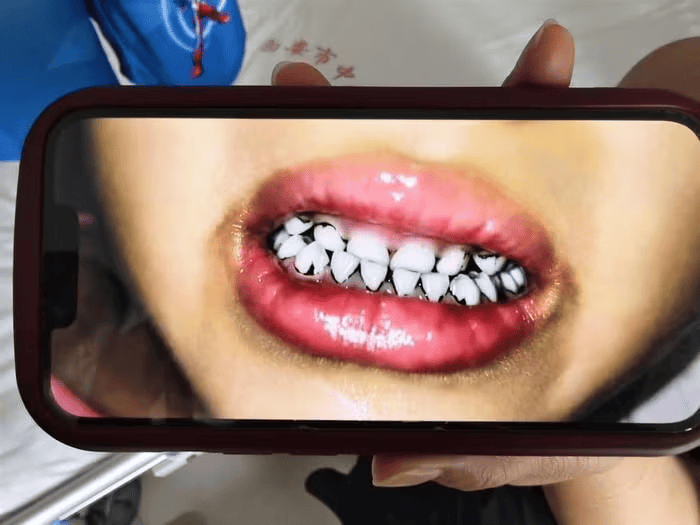 家长接到劝返电话“回甘肃去治”<strong></p>
<p>imtoken最新版本下载</strong>，幼儿血铅中毒事件更多细节曝光