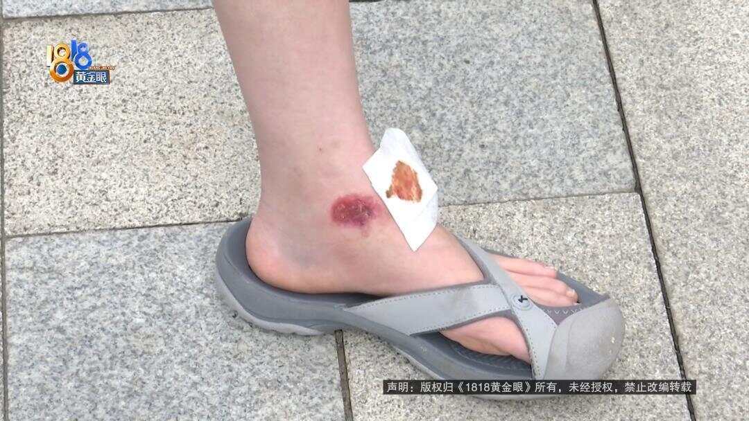 女子下班回家被外卖骑手撞伤 外卖小哥:<strong></p>
<p>LTC</strong>我只有三块钱