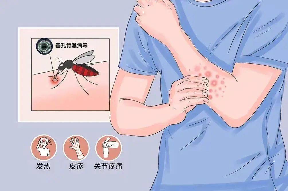 风险增大<strong></p>
<p>okb行情</strong>!深圳疾控:去这247处要小心!张文宏首次发声