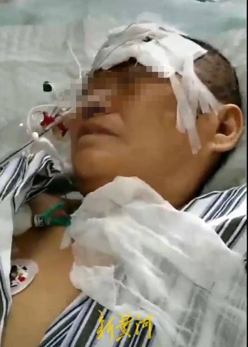 六旬老人遭狩猎者枪击致重伤，开枪者两次逃离现场，事发4小时后冒充“好心人”施救，家属：耽误了最佳救治时间