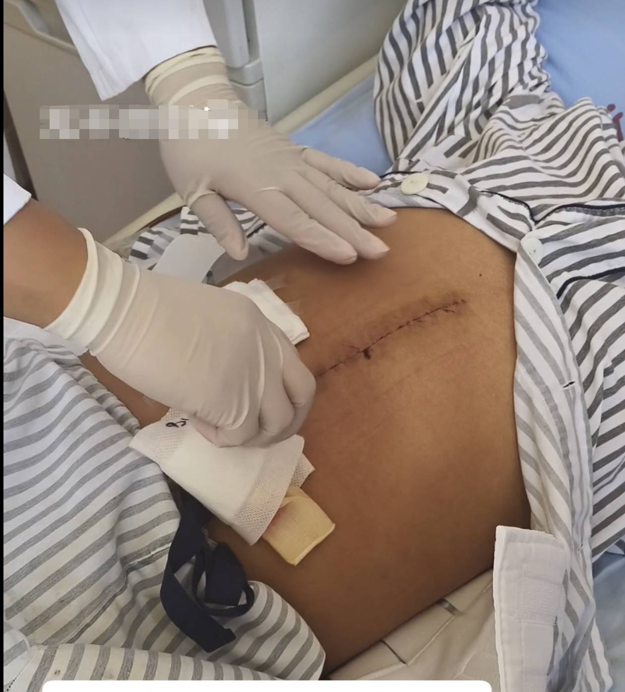 奶奶在哭<strong></p>
<p>tp钱包</strong>，宝宝在笑！40天女婴重病，00后父亲割肝救女，术后这一幕让网友泪奔