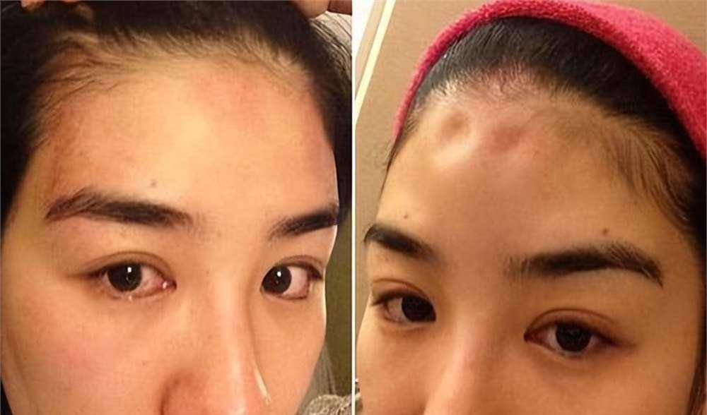 罗霖被家暴17年<strong></p>
<p>TRX币</strong>，蓝洁瑛遭性侵暴力还被围观！女明星的暴力事件还有很多