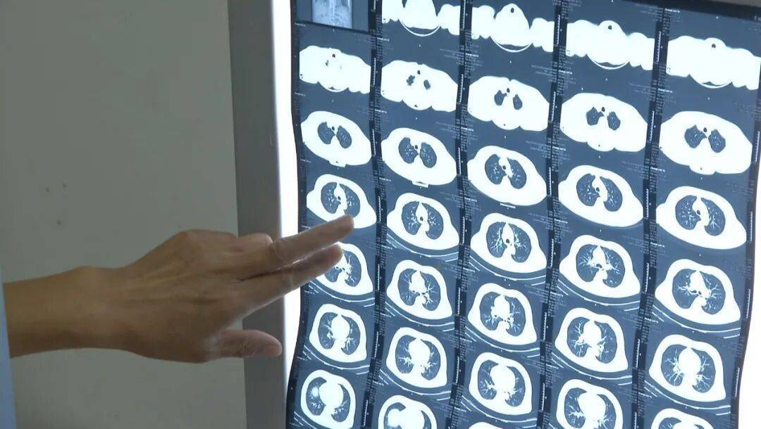 许多患者没有症状<strong></p>
<p>usdt暴跌</strong>，发病就猝死！警惕这种心脏疾病