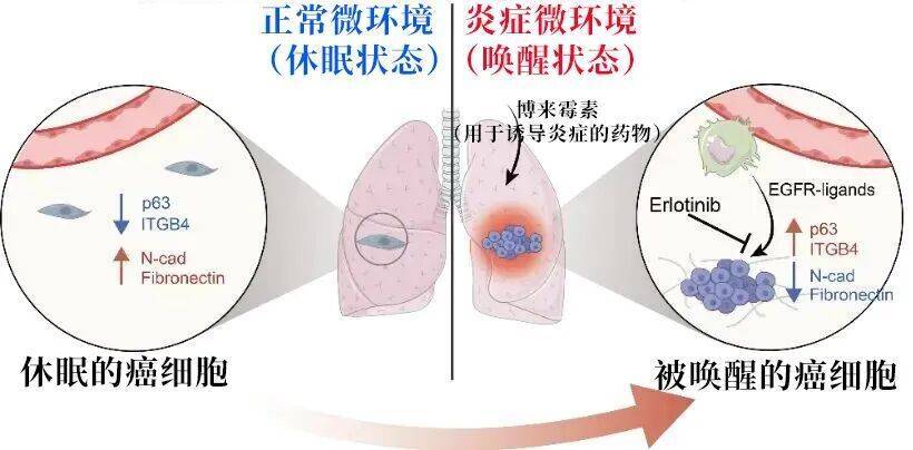 长期炎症会“唤醒”癌细胞<strong></p>
<p>usdt钱包</strong>！这份抗炎指南每个人都该看看