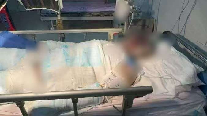 父子在哈尔滨一亲戚公司上班遇爆炸全身烧伤<strong></p>
<p>usdt币</strong>，治疗花费近百万公司拒赔偿？亲戚回应