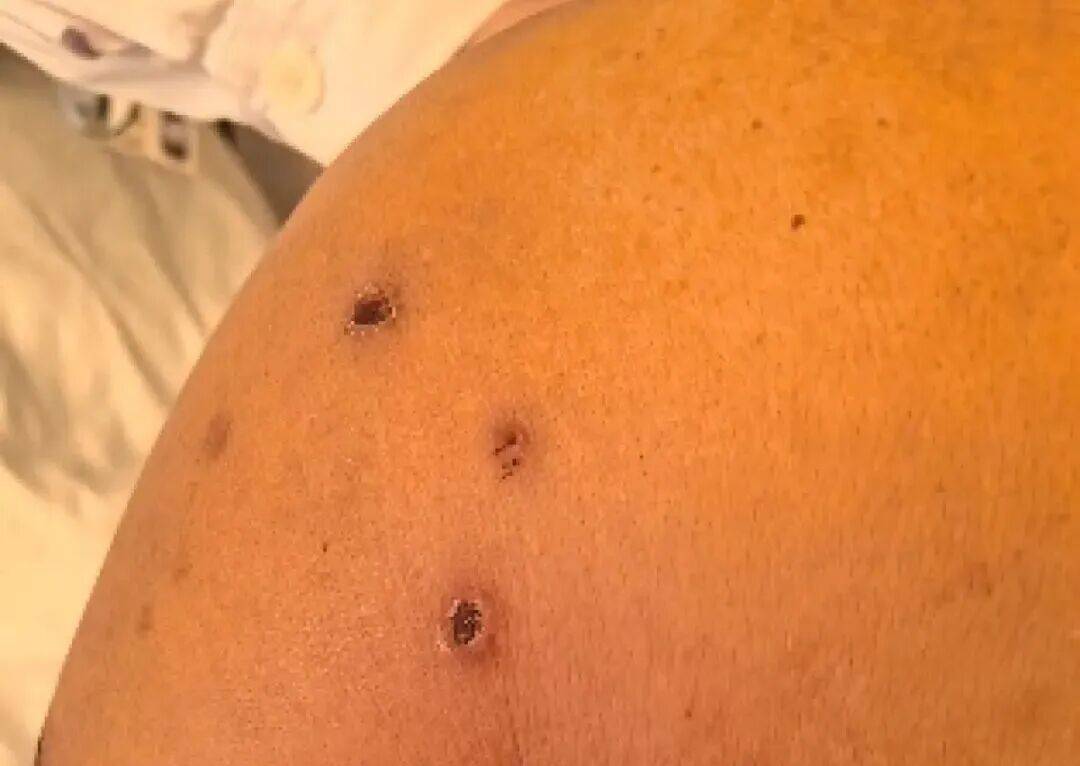 深圳一市民突遭马蜂围袭！已进入高发期<strong></p>
<p>usdt币</strong>，千万别招惹！