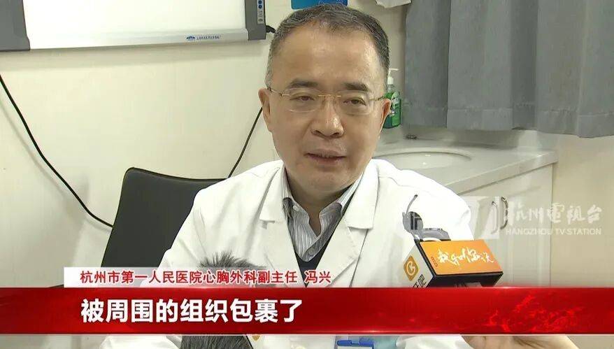 17岁小伙参军体检发现胸腔内有根5cm缝衣针<strong></p>
<p>巨力索具股票</strong>，父母回忆或是1岁时扎入，取出时已锈迹斑斑